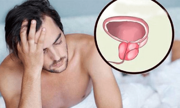 Prostatitisaren sintomak